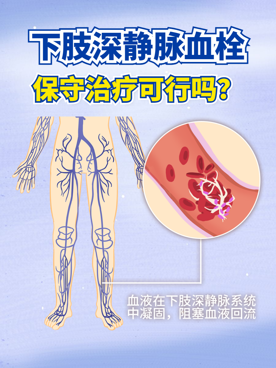 静脉血栓怎么治疗比较好