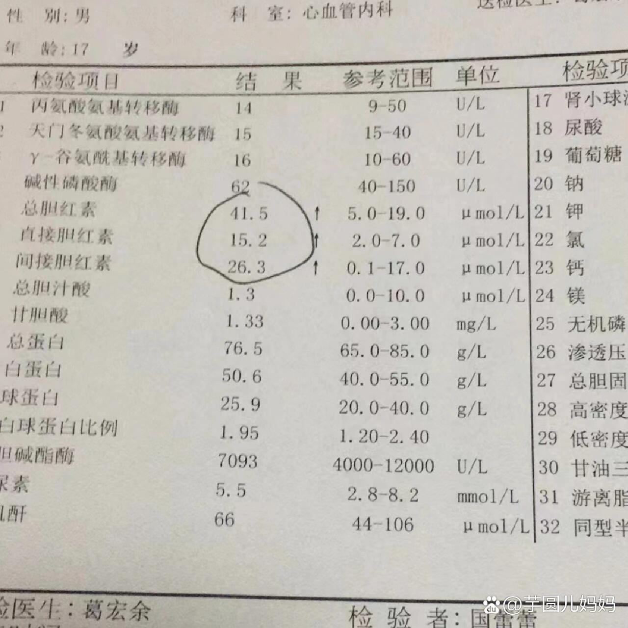 血清总胆红素偏高、是什么造成的