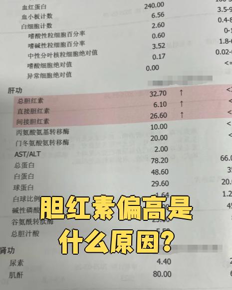 间接胆红素偏高些是什么问题?