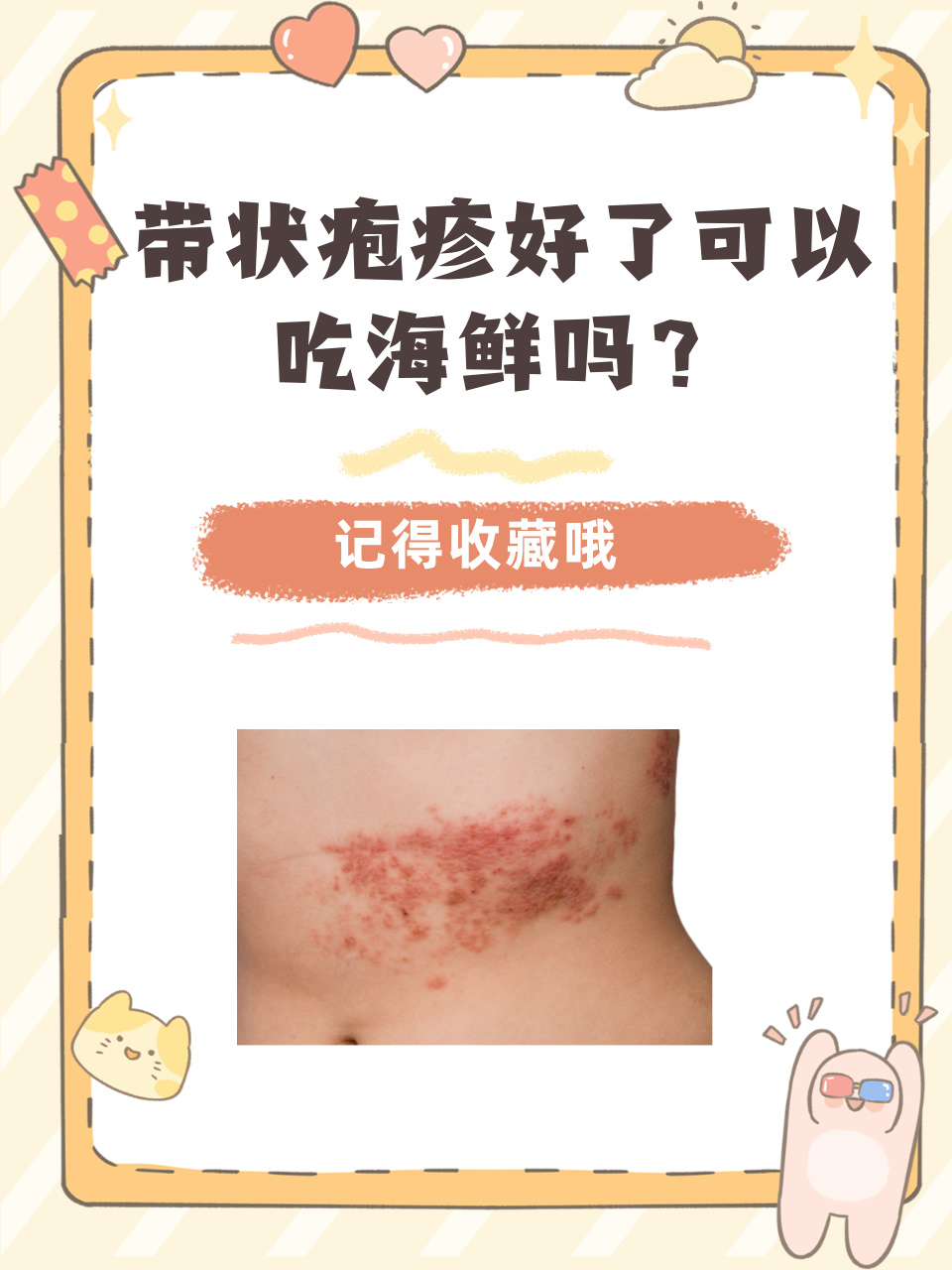 带状疱疹可以自愈吗?