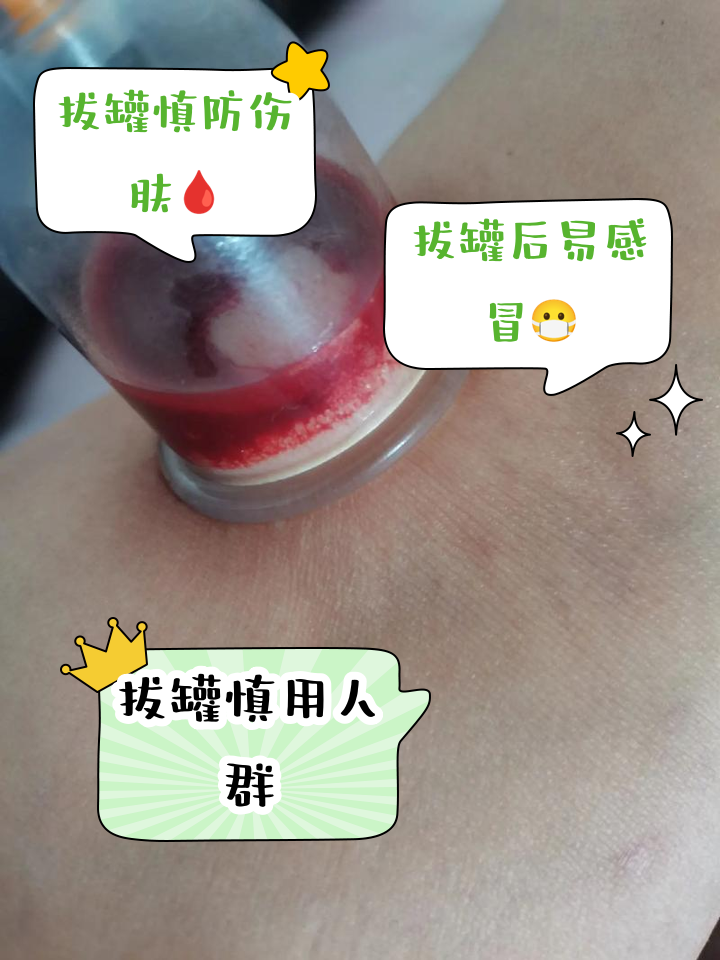 刺血疗法的害处