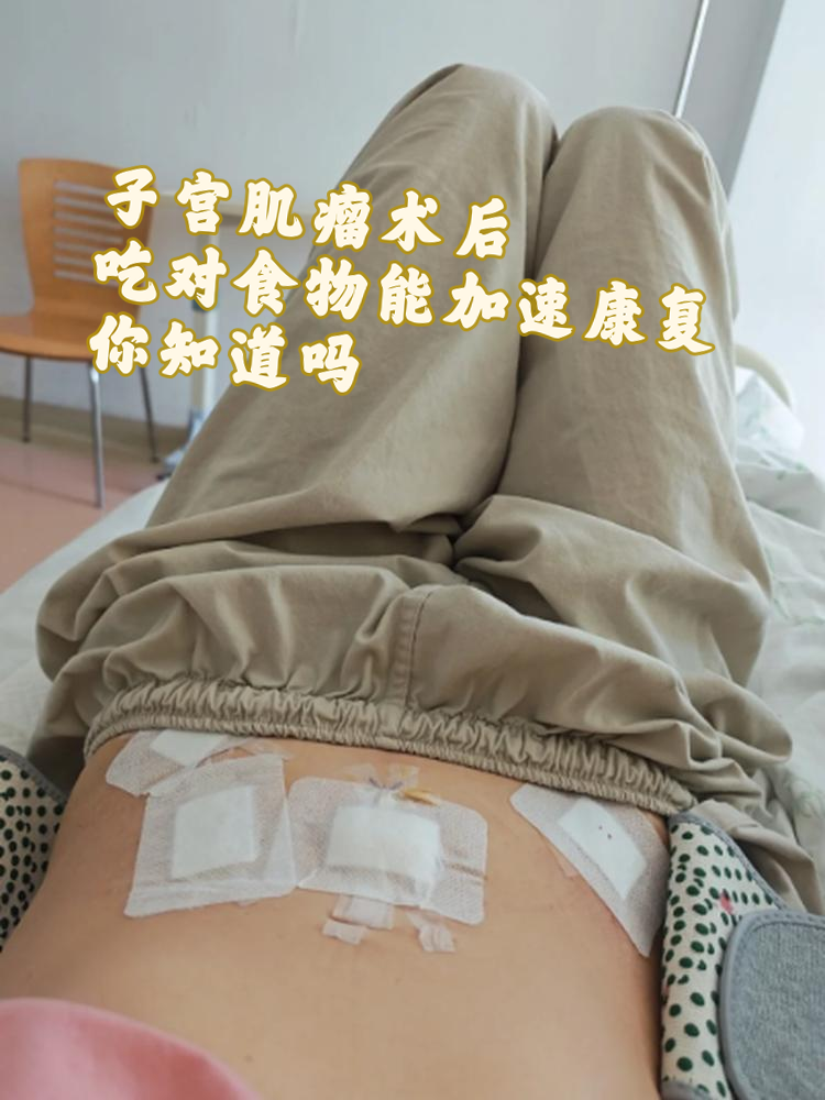 子宫肌瘤最佳治疗方式