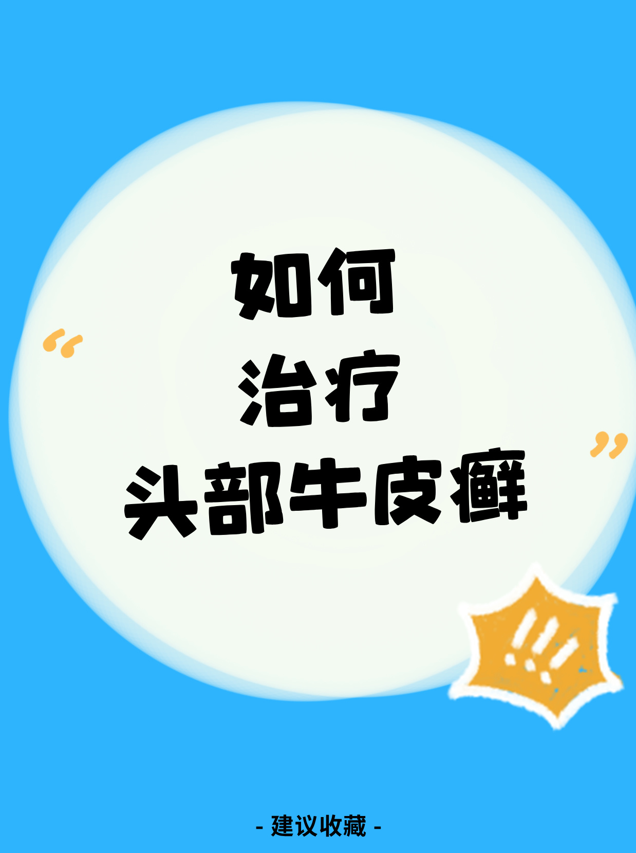 治疗牛皮癣的方法有哪些