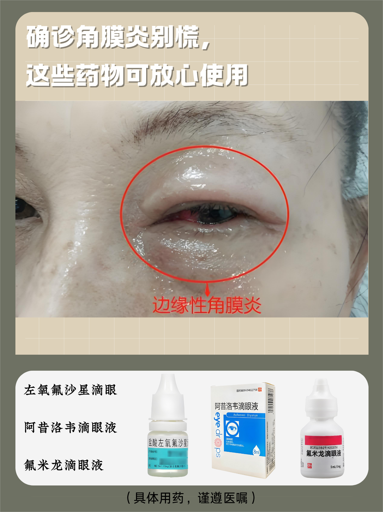 角膜炎能治好吗