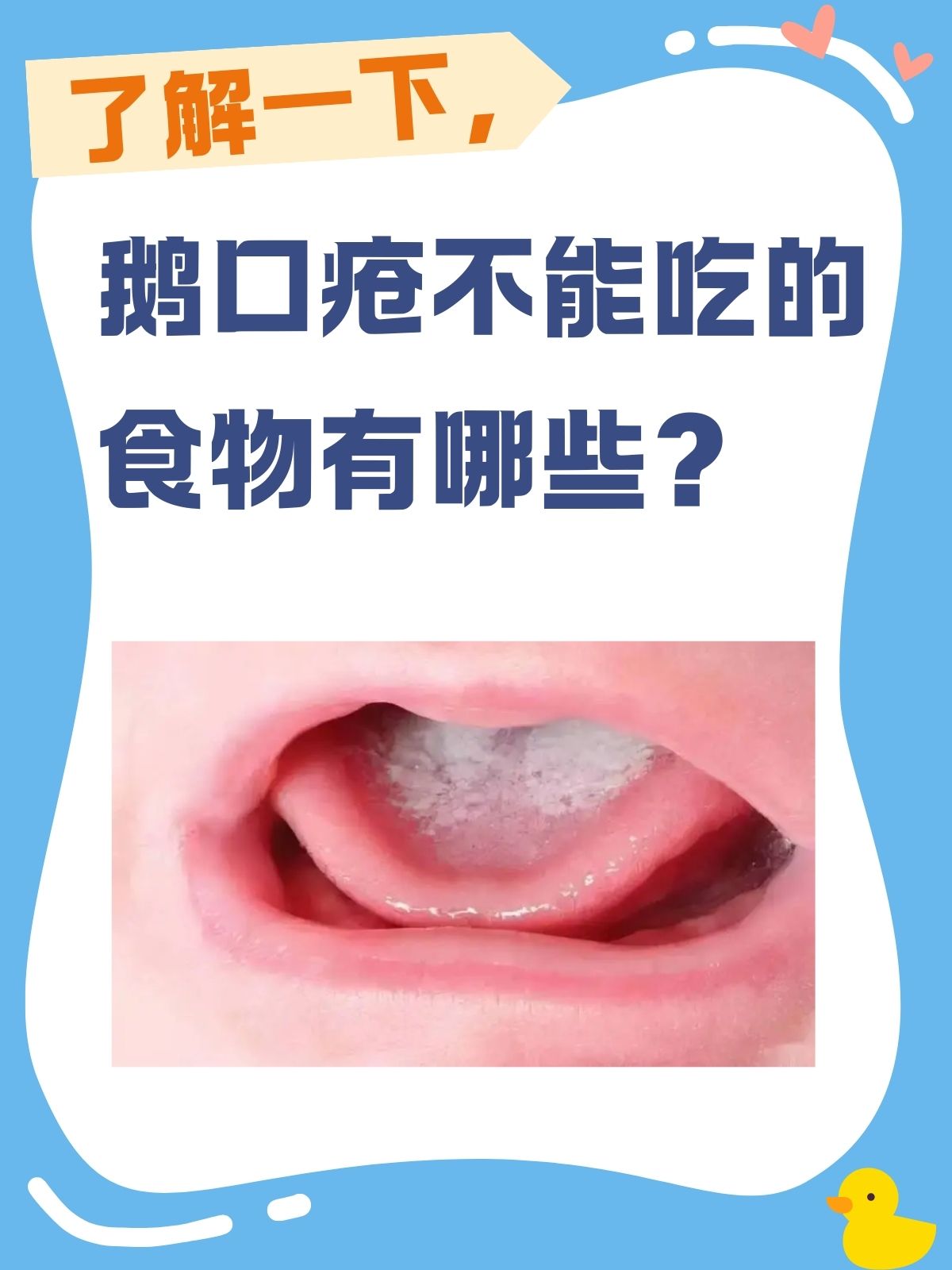 鹅口疮是什么引起的