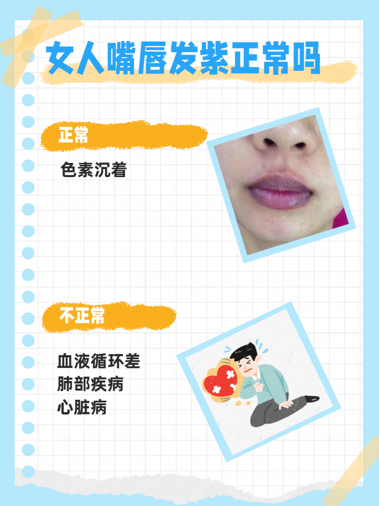 嘴唇发紫怎么调节?