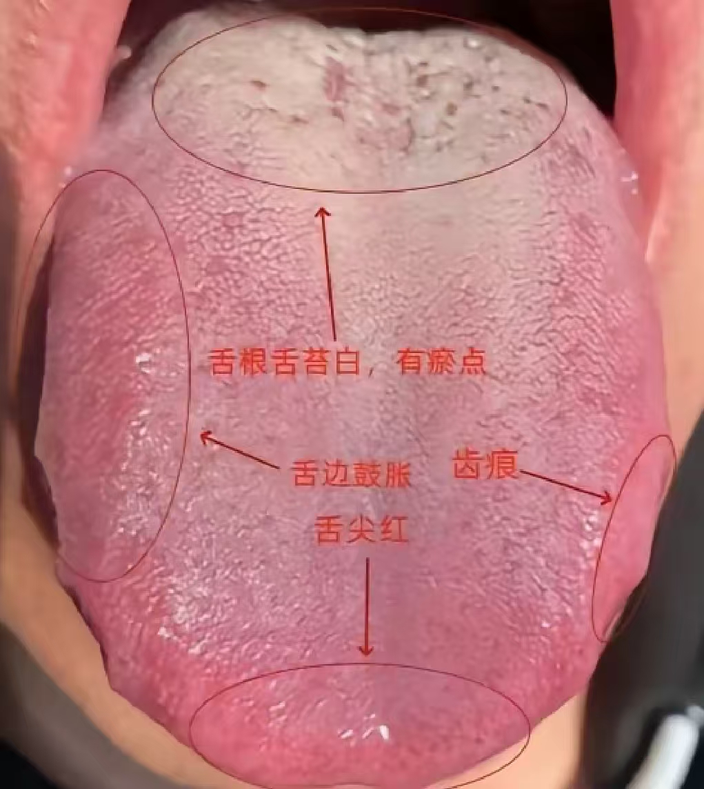 舌头有红点,,正常吗