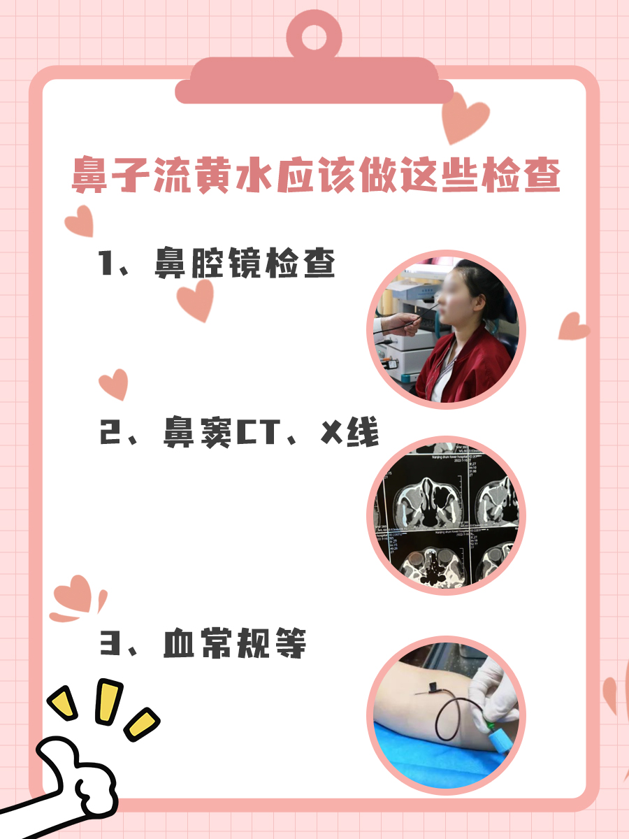 鼻子流黄水是脑脊液吗