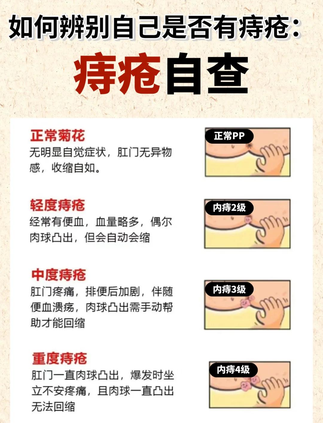 混合痔的最佳治疗方法