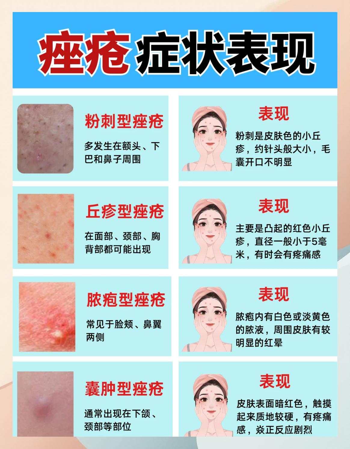 眉头长痘痘,是怎么回事