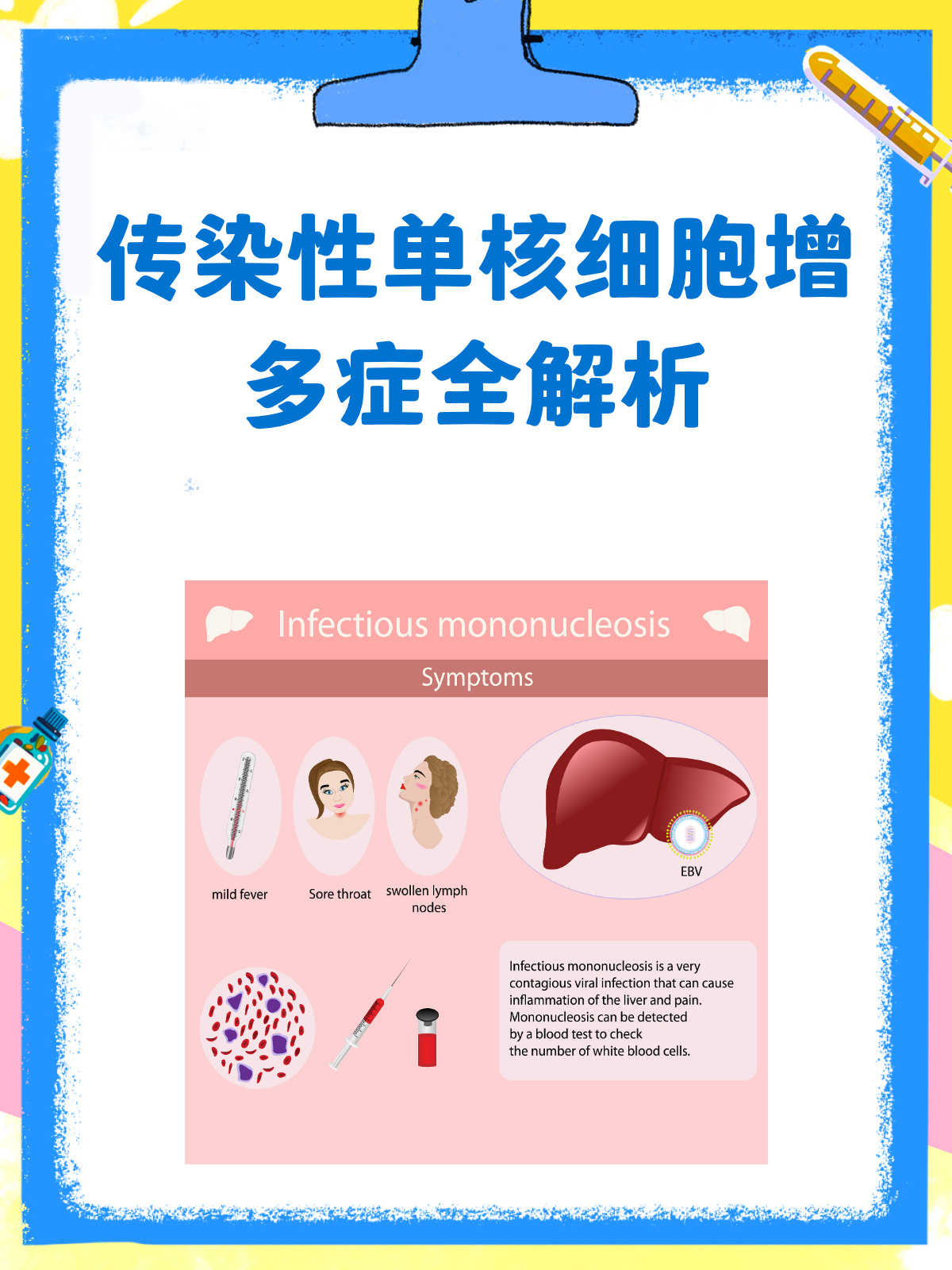 单核细胞增多症好治吗