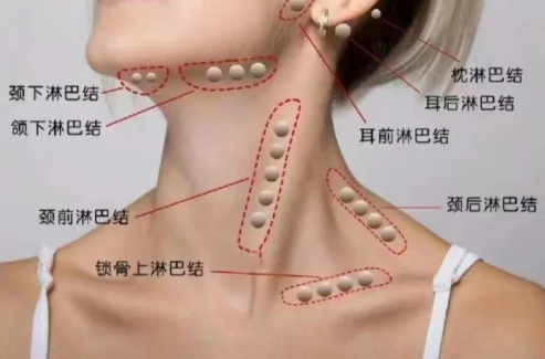 颈部淋巴结挂什么科