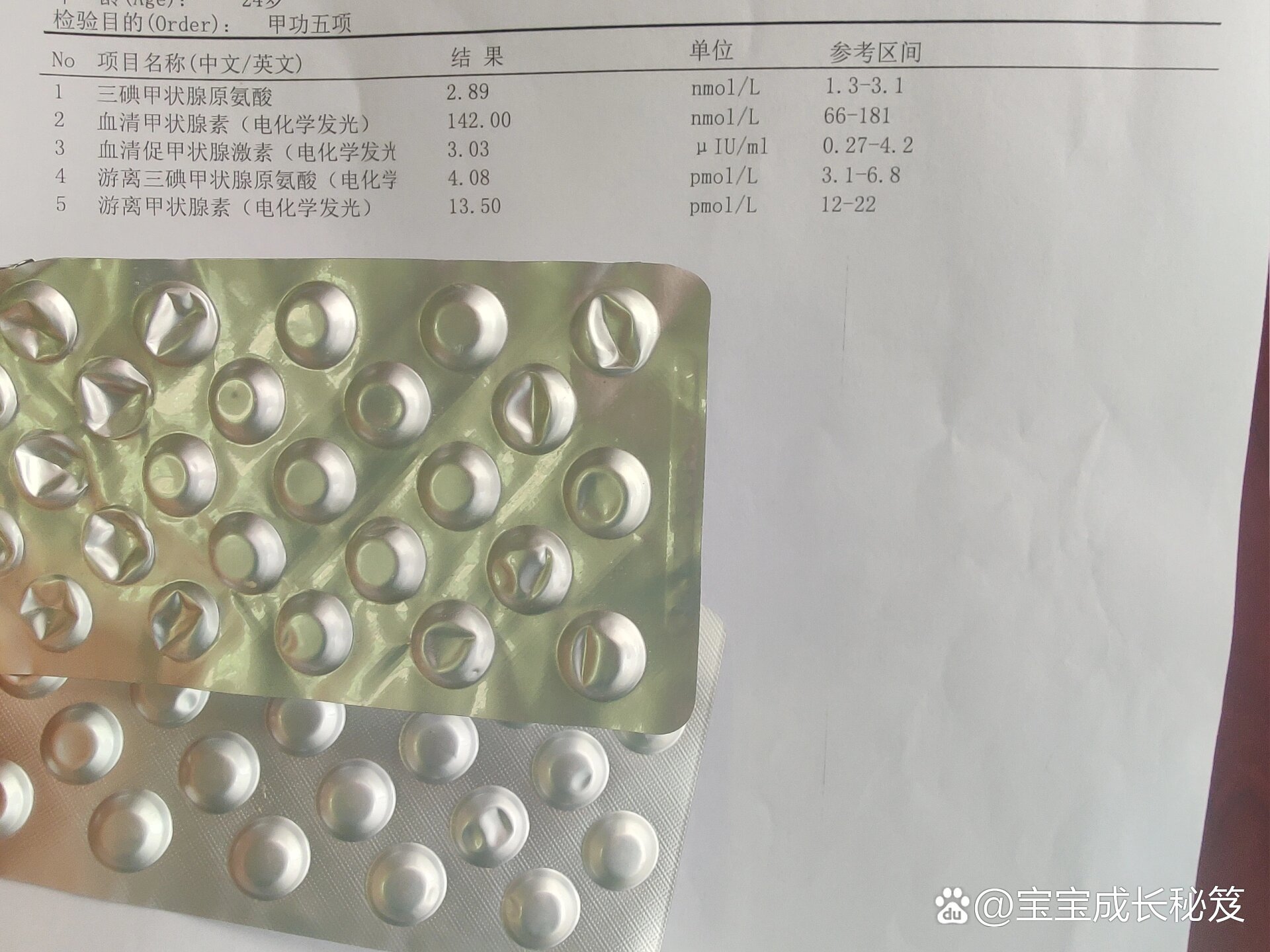 甲减孕妇出生的小孩正常吗