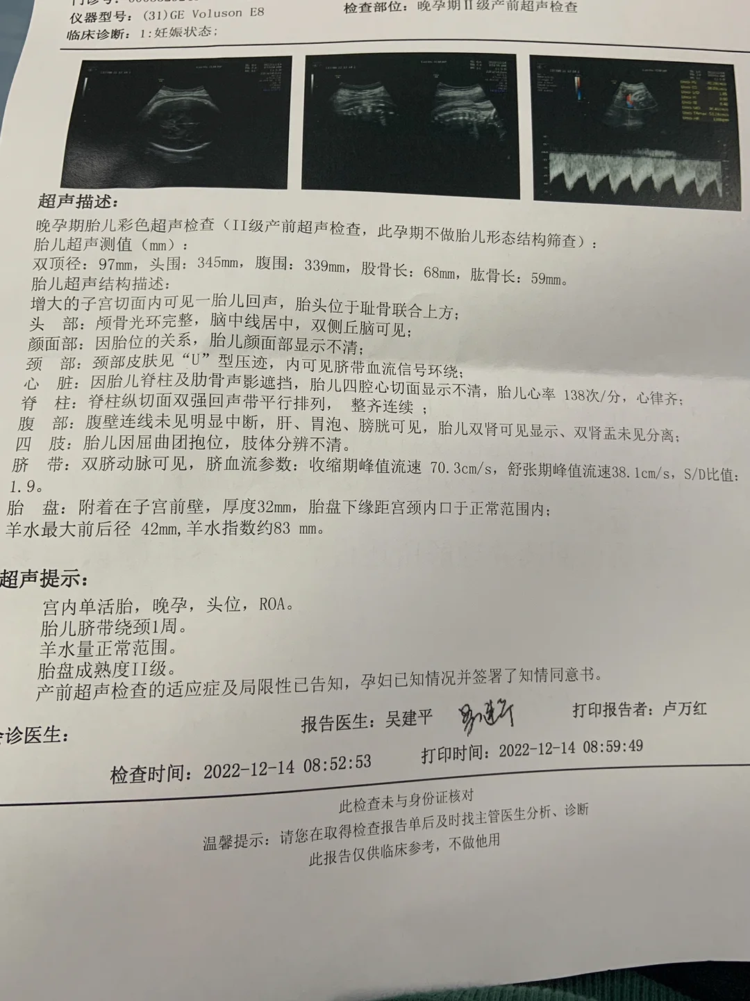 胎儿钙化是什么原因造成的