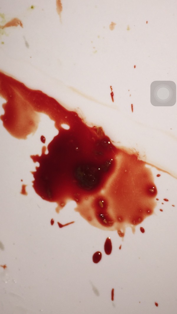 上厕所,大便出血还很疼