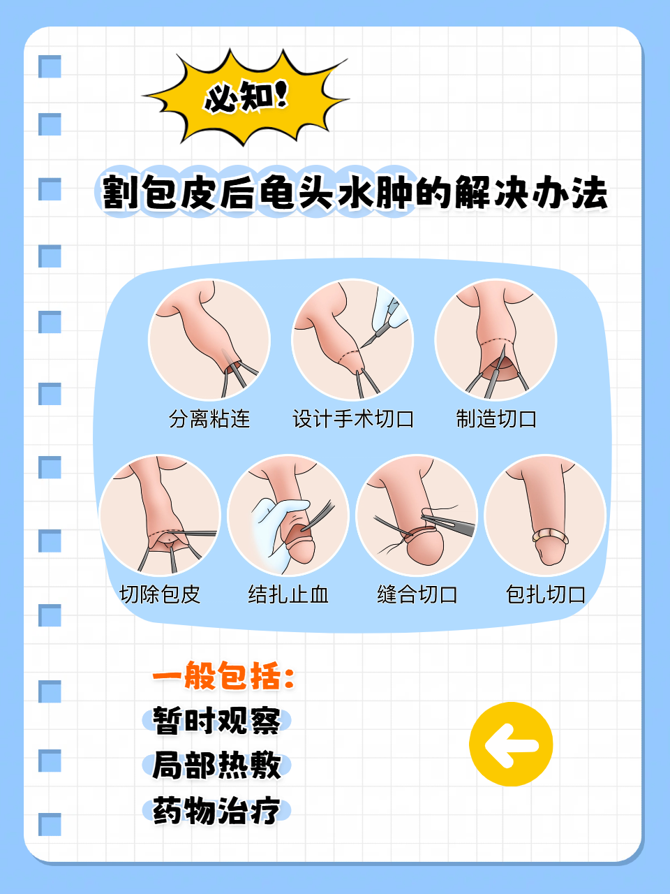 包皮手术快速恢复