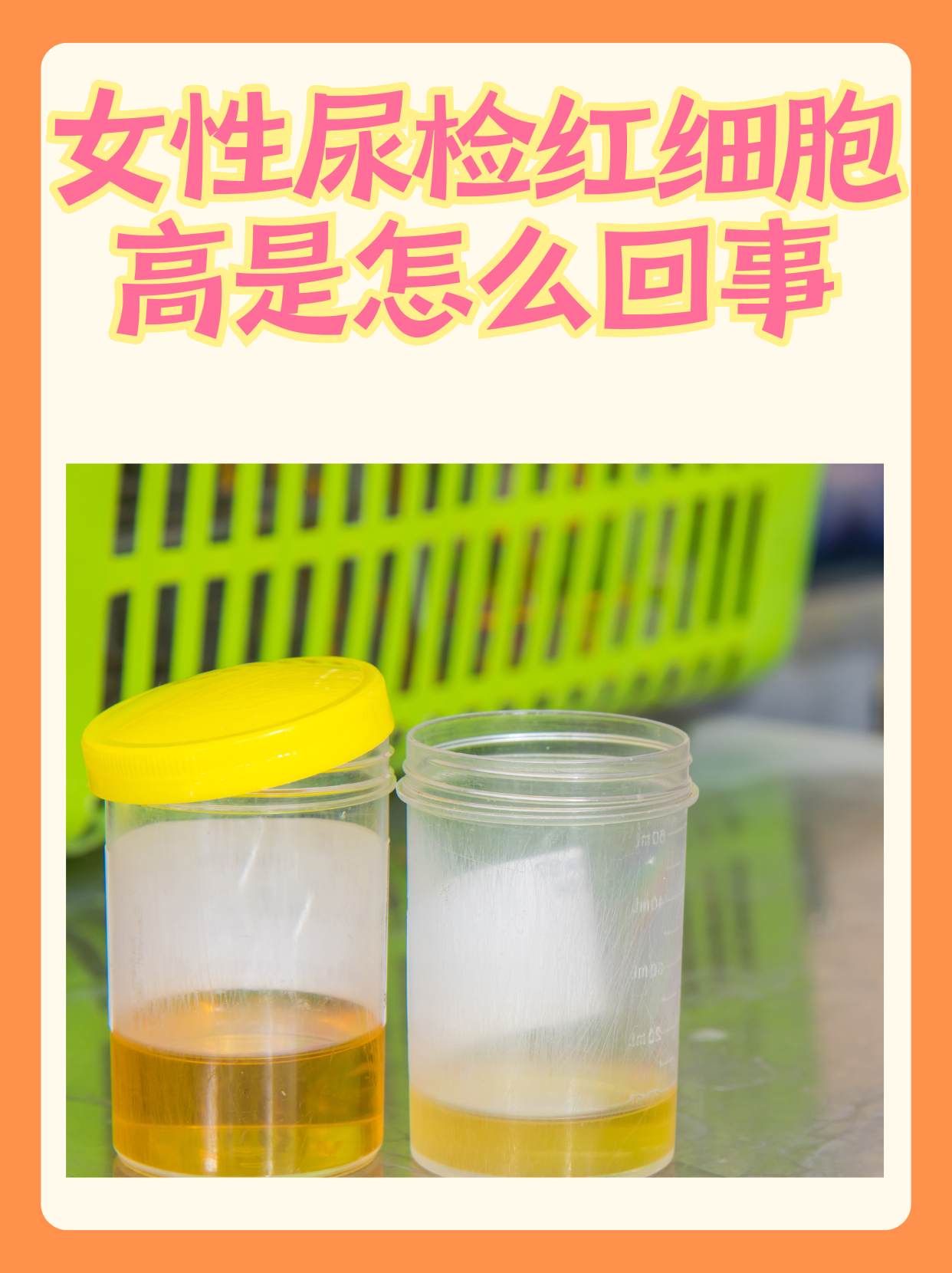 尿常规中粘液丝高是怎么回事