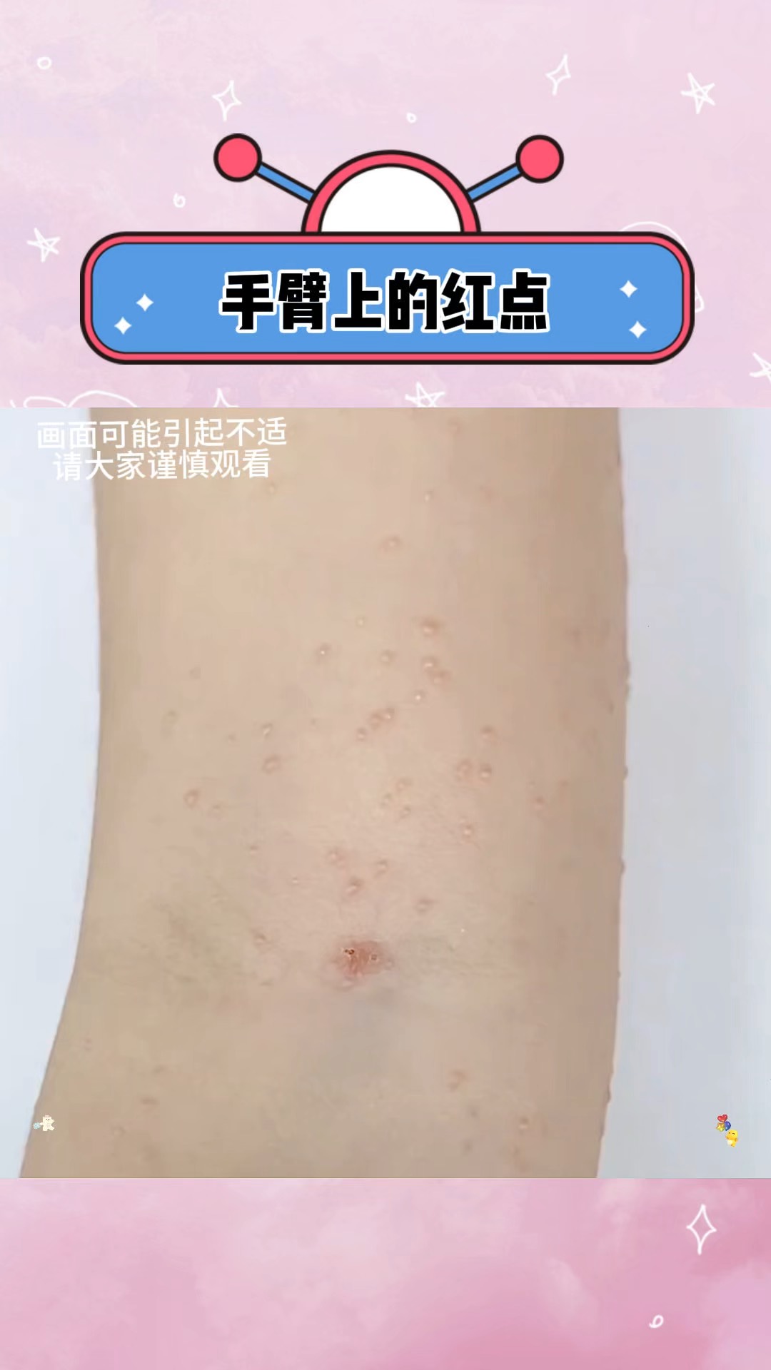 手臂上出现红点怎么回事??