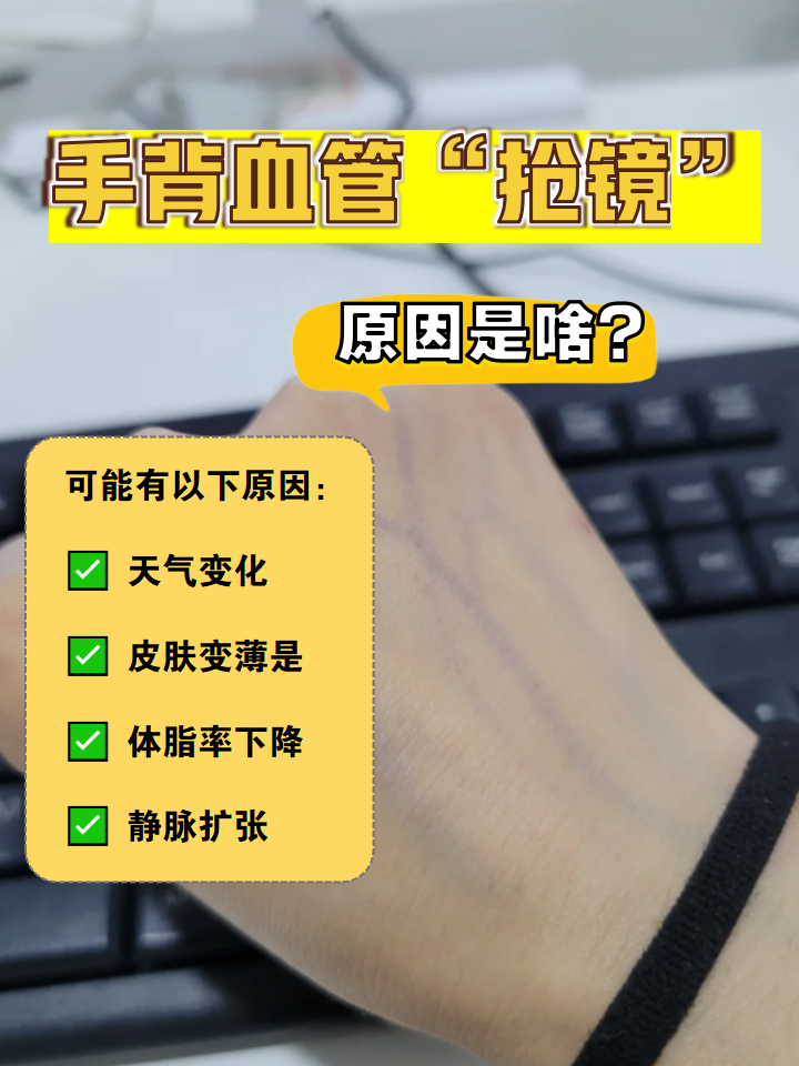 手上血管突出是怎么回事