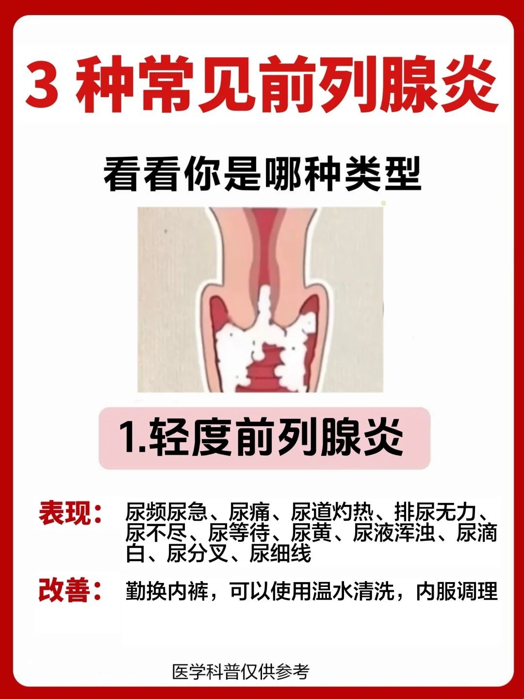 男性前列腺炎有什么表现