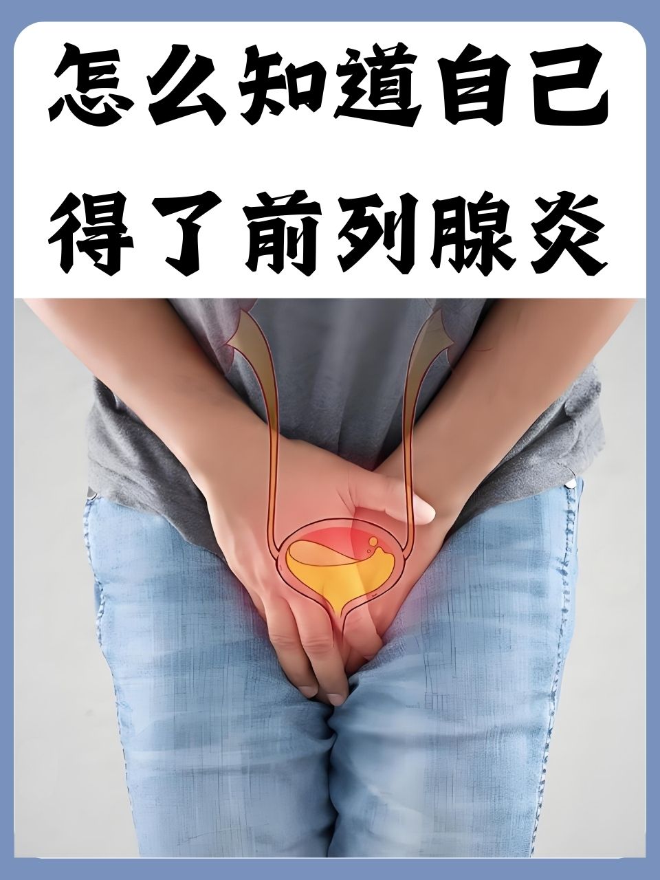 男性前列腺炎有什么表现