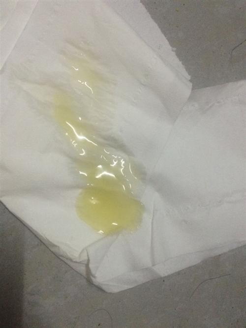 精液很稀像水一样正常吗