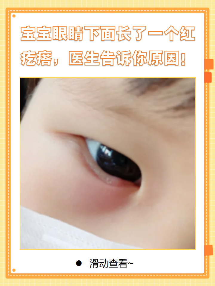 眼皮下长的小疙瘩是什么