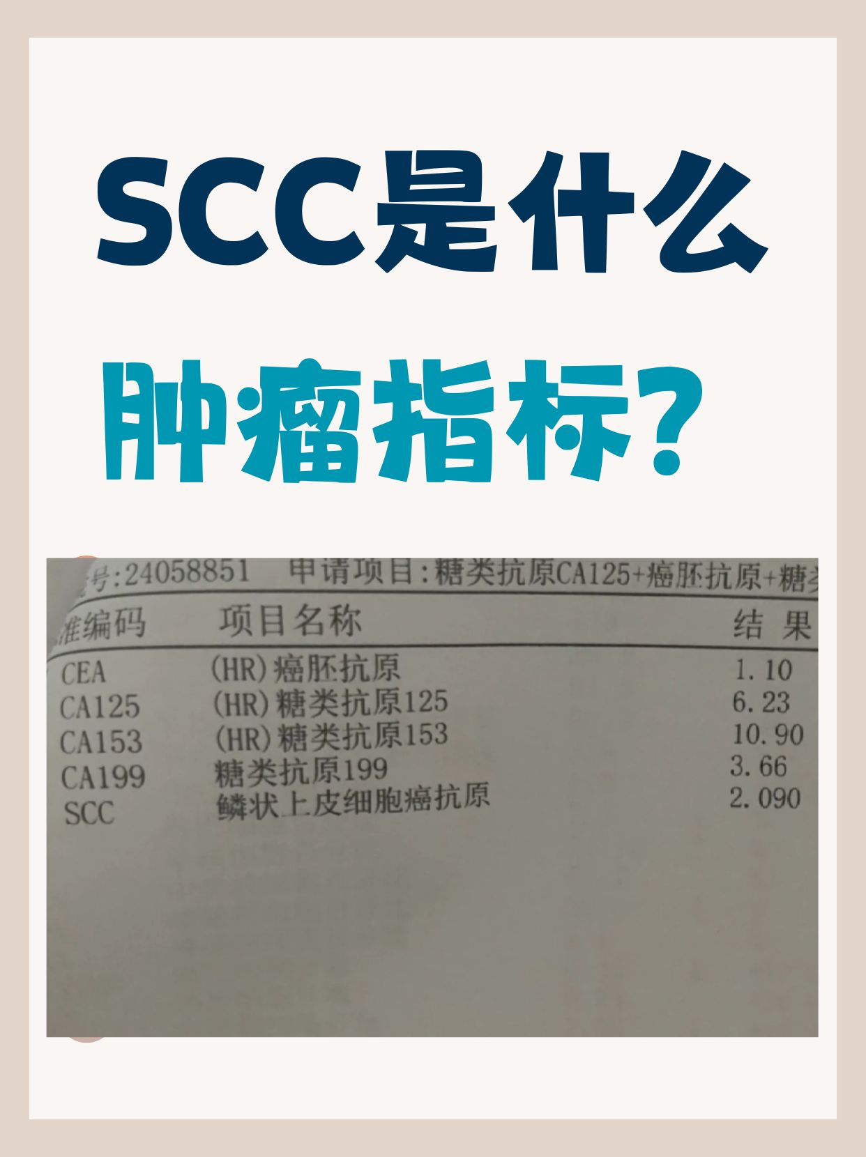 cea癌胚抗原偏高是怎么回事