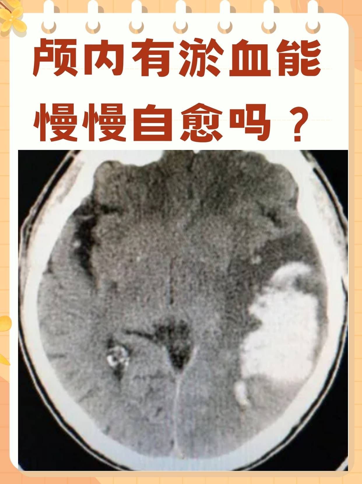 脑部供血不足的症状有哪些