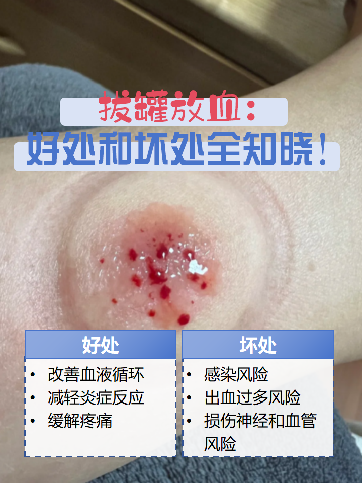 血泡刺是什么样?又该如何治疗