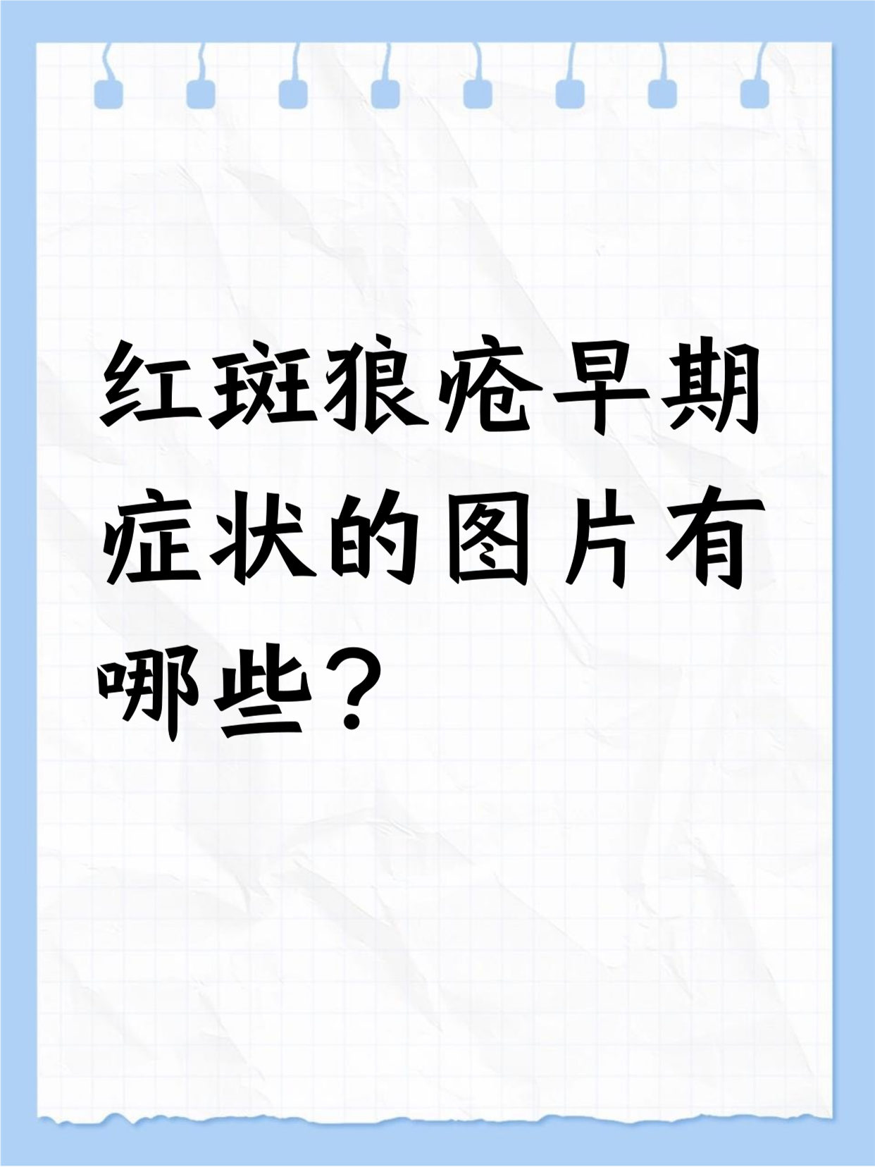 红斑狼疮的病因有哪些?