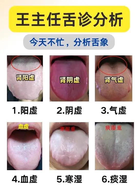 舌头发白是什么原因