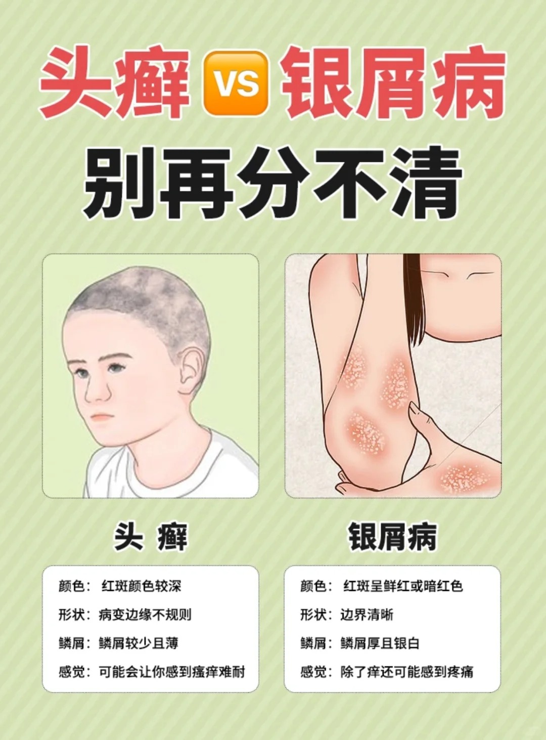 银屑病是怎么回事?