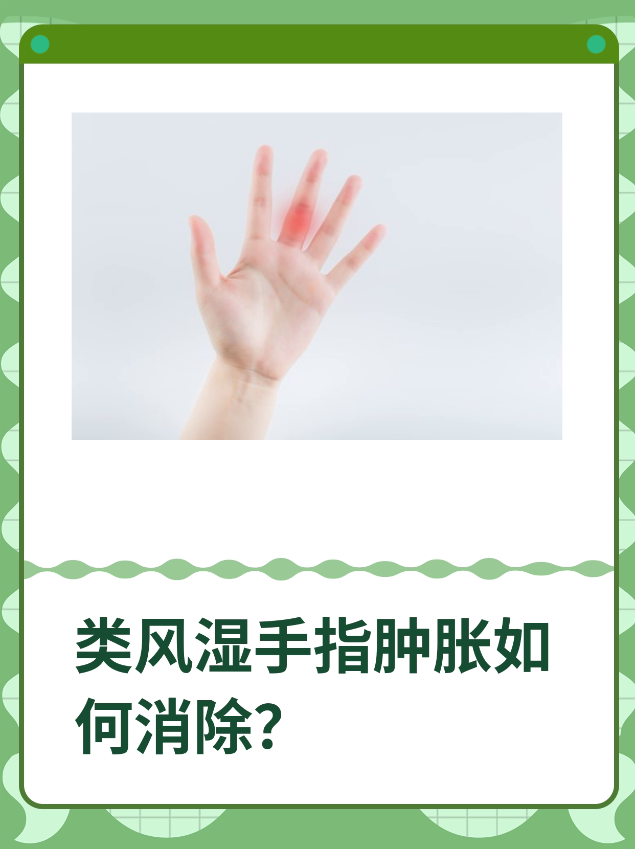 手冻肿了,该如何快速消肿?