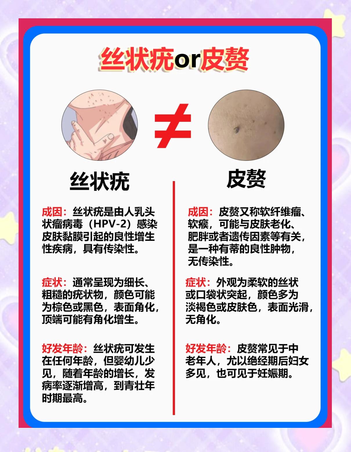 丝状疣怎么治疗方法