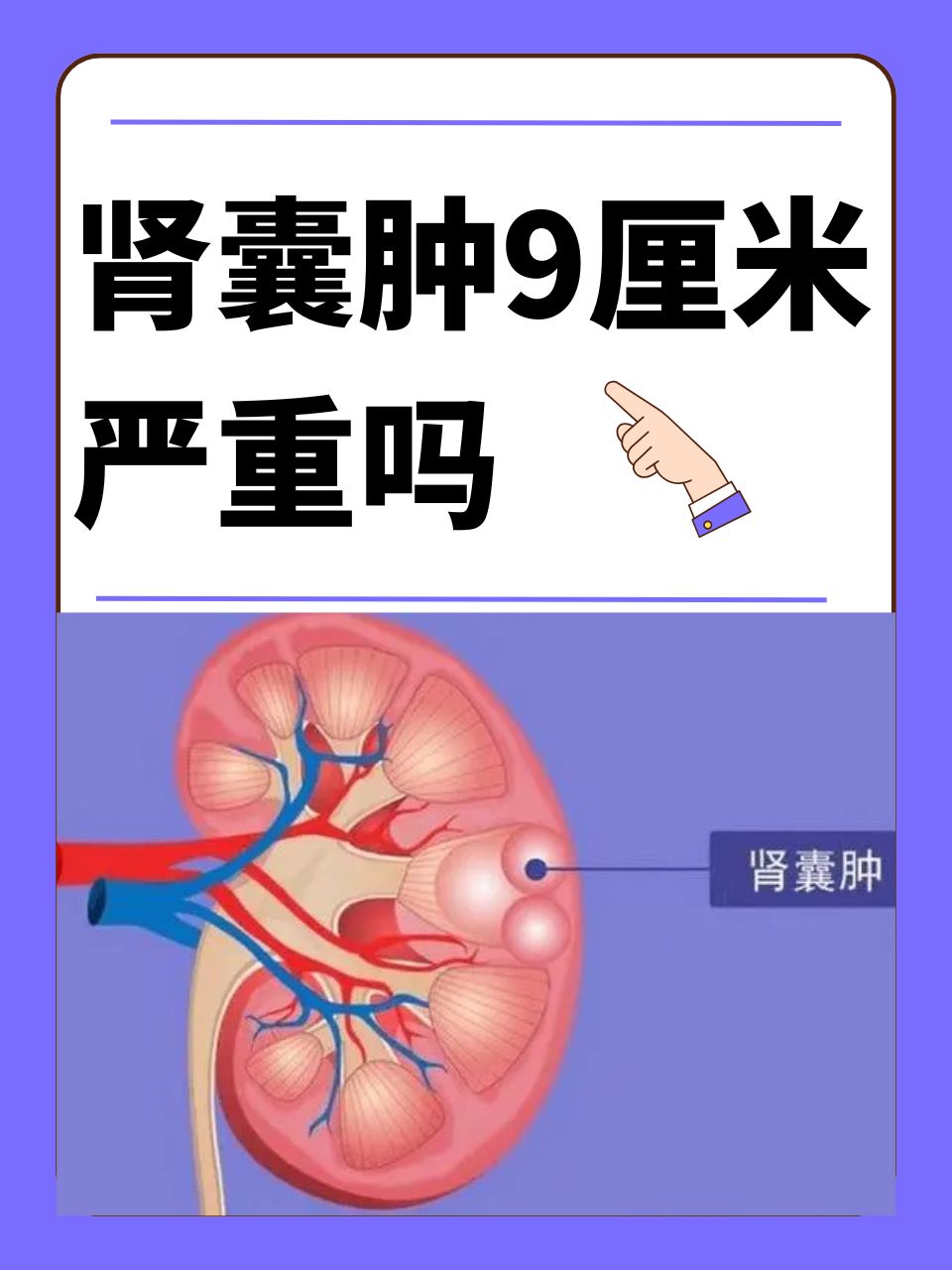 肾囊肿是咋回事