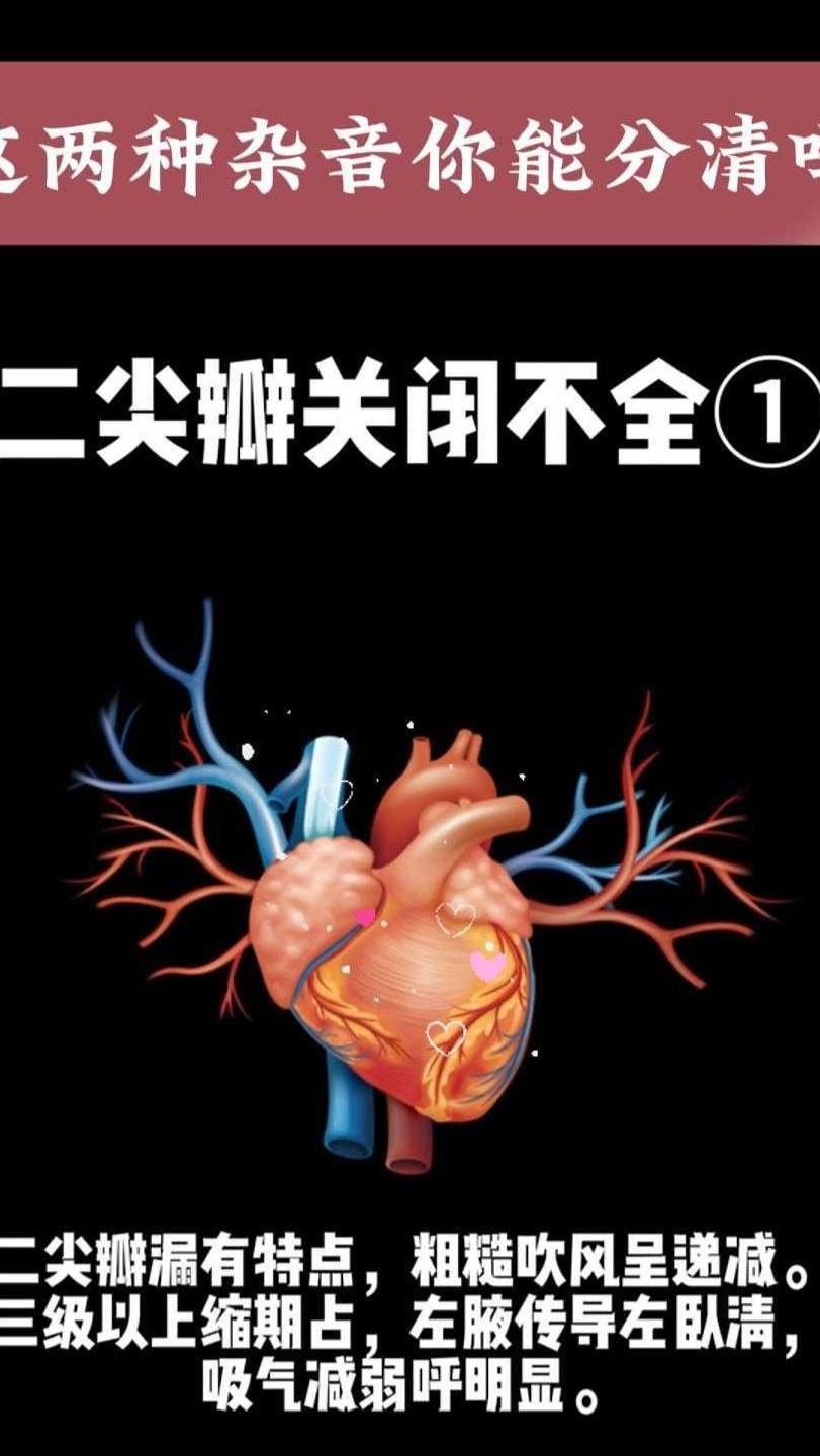 二尖瓣关闭不全是什么意思