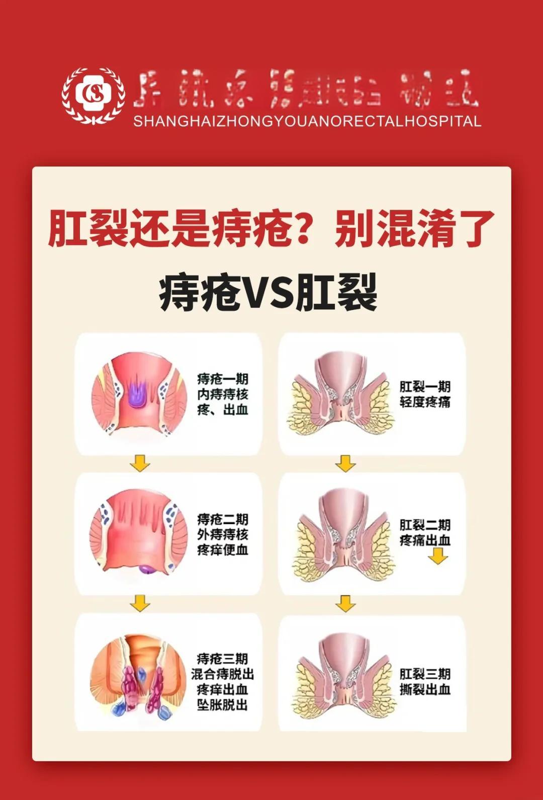 肛门出血是什么原因