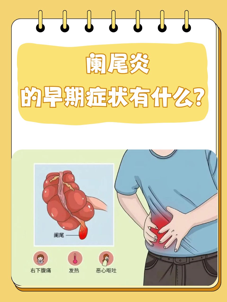 阑尾炎的症状是什么