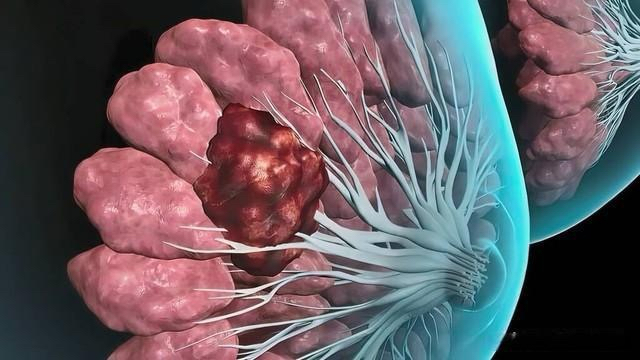 乳房有硬块,但是不疼