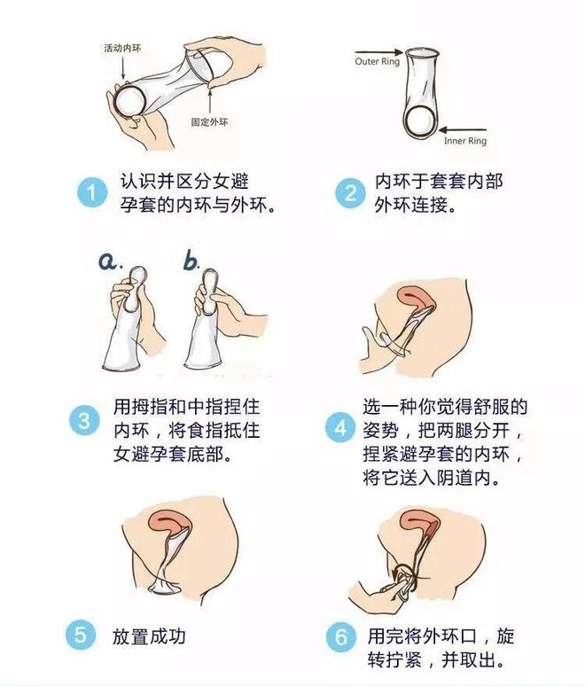 怎么使用避孕套