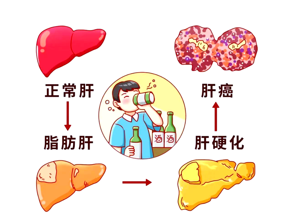 酒精肝能治愈吗?