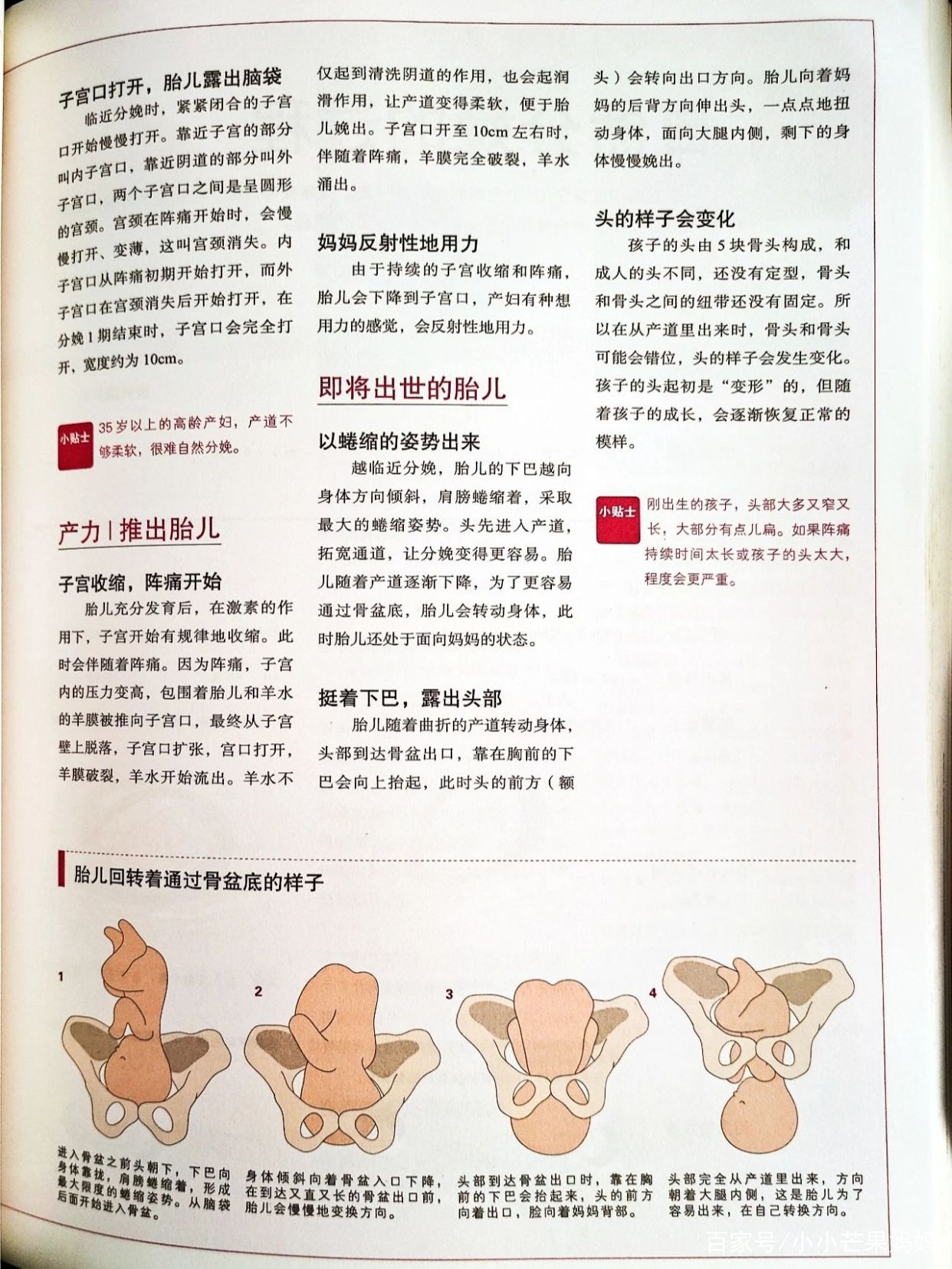 无痛分娩和顺产的区别