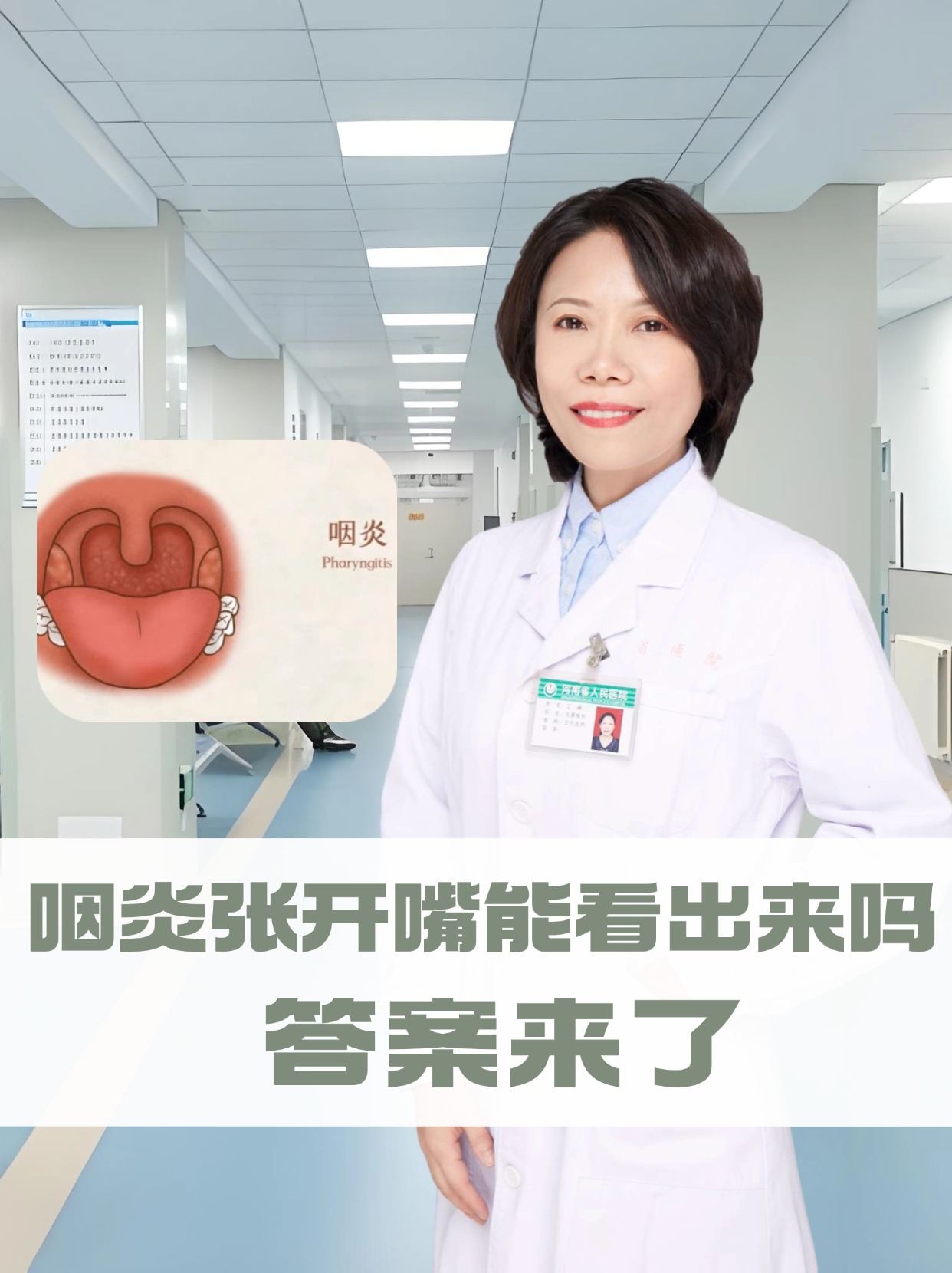 咽炎可以传染吗