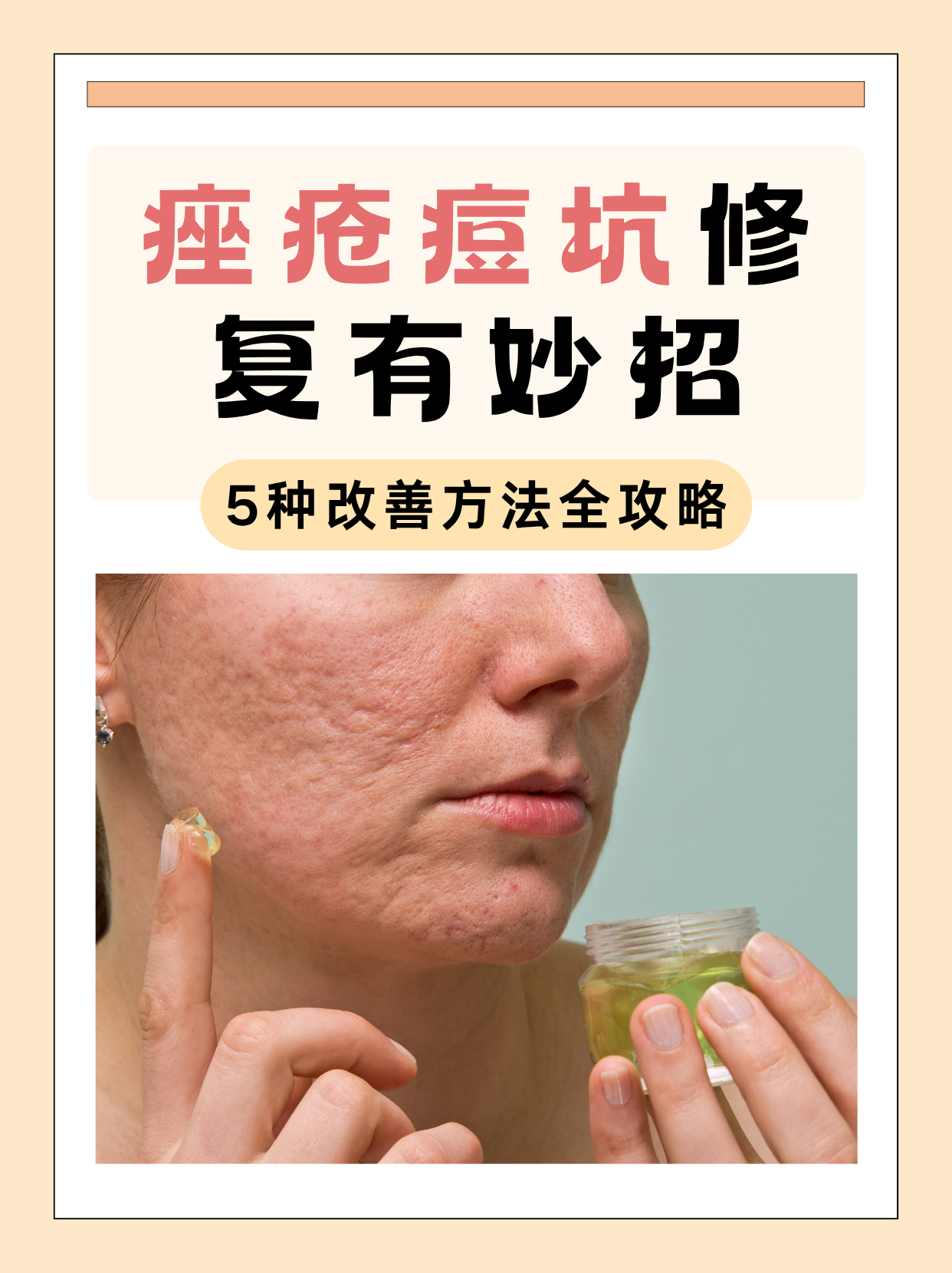 痘坑痘印用啥方法能去除