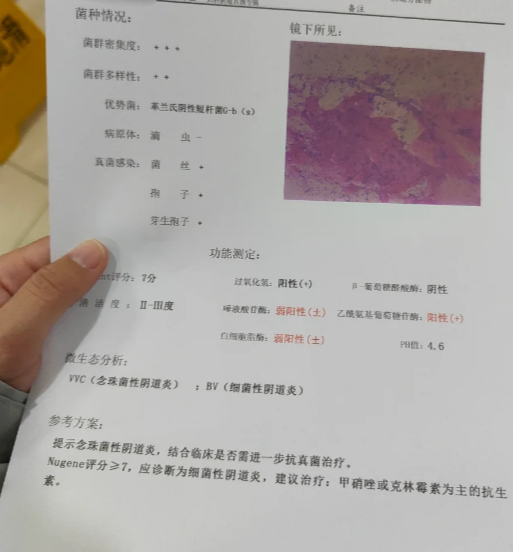 白带带血怎么回事啊