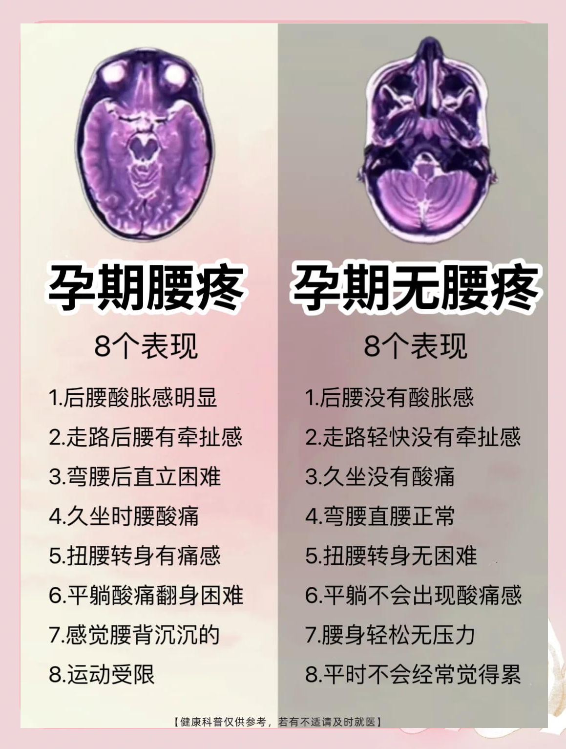 怀孕了腿疼怎么回事