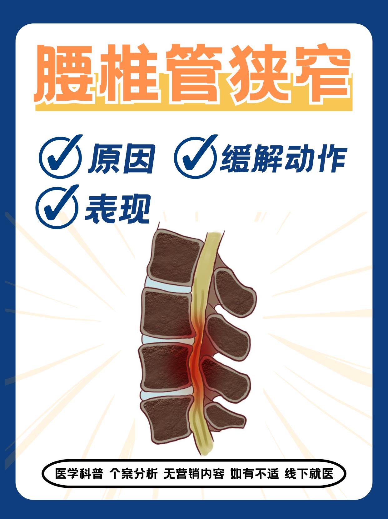 腰椎增生怎么办?