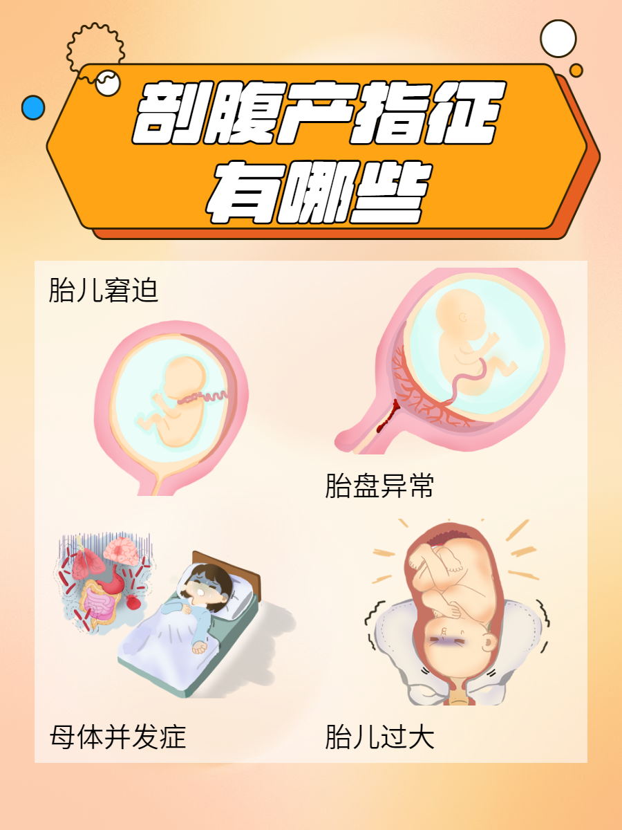 二胎剖腹产比一胎疼吗?