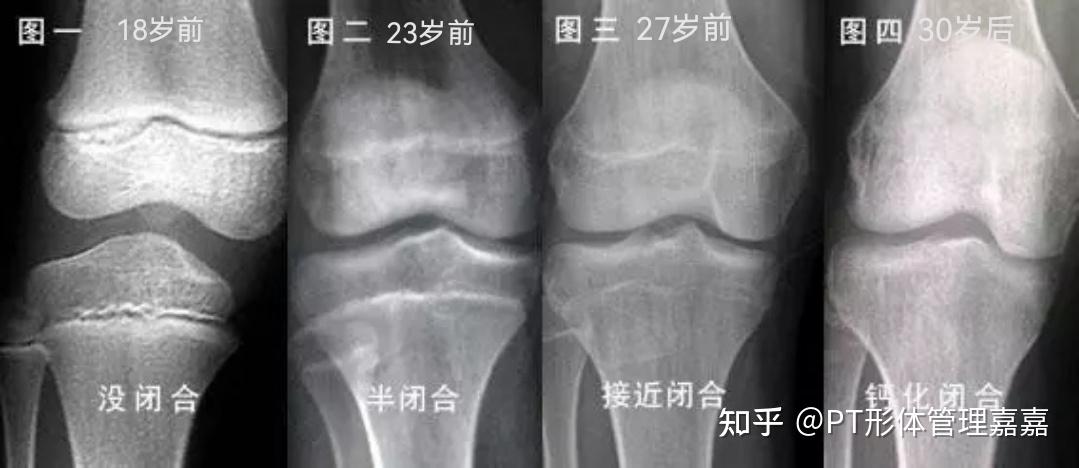 30岁还有机会长高吗?